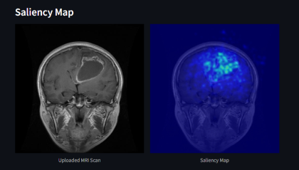 Brain Tumor Classifier